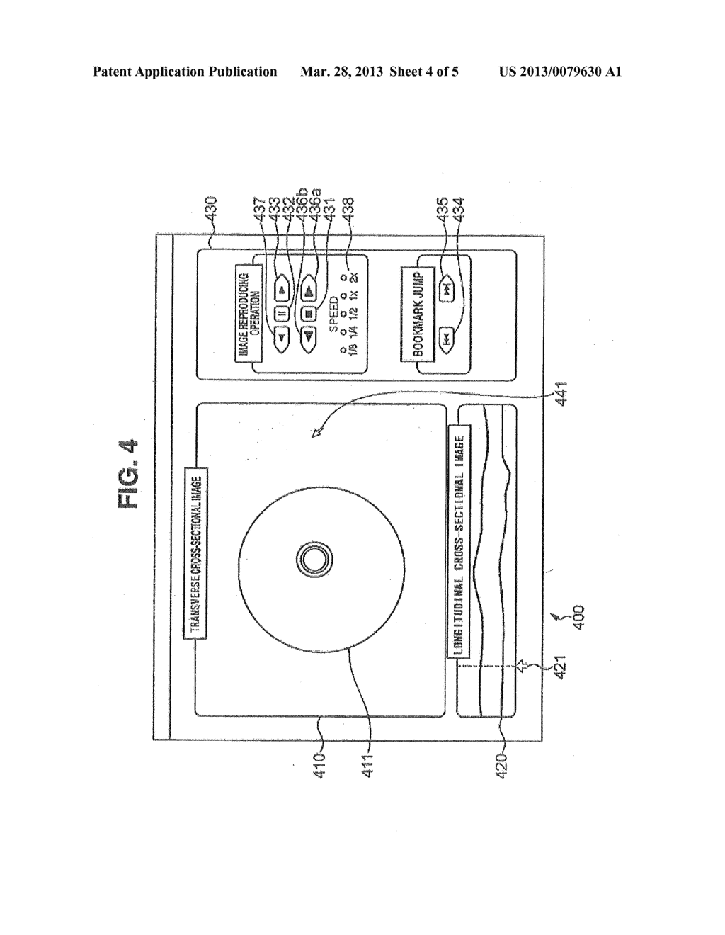 IMAGING APPARATUS FOR DIAGNOSIS - diagram, schematic, and image 05