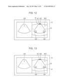 ULTRASOUND DIAGNOSTIC APPARATUS AND METHOD THEREOF diagram and image