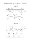 ULTRASOUND DIAGNOSTIC APPARATUS AND METHOD THEREOF diagram and image