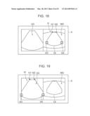 ULTRASOUND DIAGNOSTIC APPARATUS AND METHOD THEREOF diagram and image