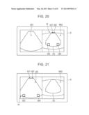 ULTRASOUND DIAGNOSTIC APPARATUS AND METHOD THEREOF diagram and image