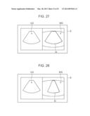 ULTRASOUND DIAGNOSTIC APPARATUS AND METHOD THEREOF diagram and image