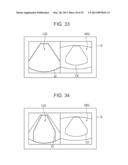 ULTRASOUND DIAGNOSTIC APPARATUS AND METHOD THEREOF diagram and image