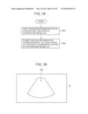 ULTRASOUND DIAGNOSTIC APPARATUS AND METHOD THEREOF diagram and image