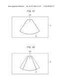 ULTRASOUND DIAGNOSTIC APPARATUS AND METHOD THEREOF diagram and image