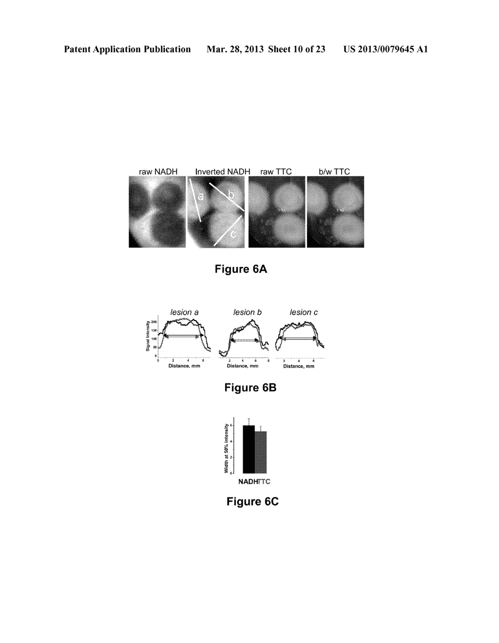 Systems and Methods for Visualizing Ablated Tissue - diagram, schematic, and image 11