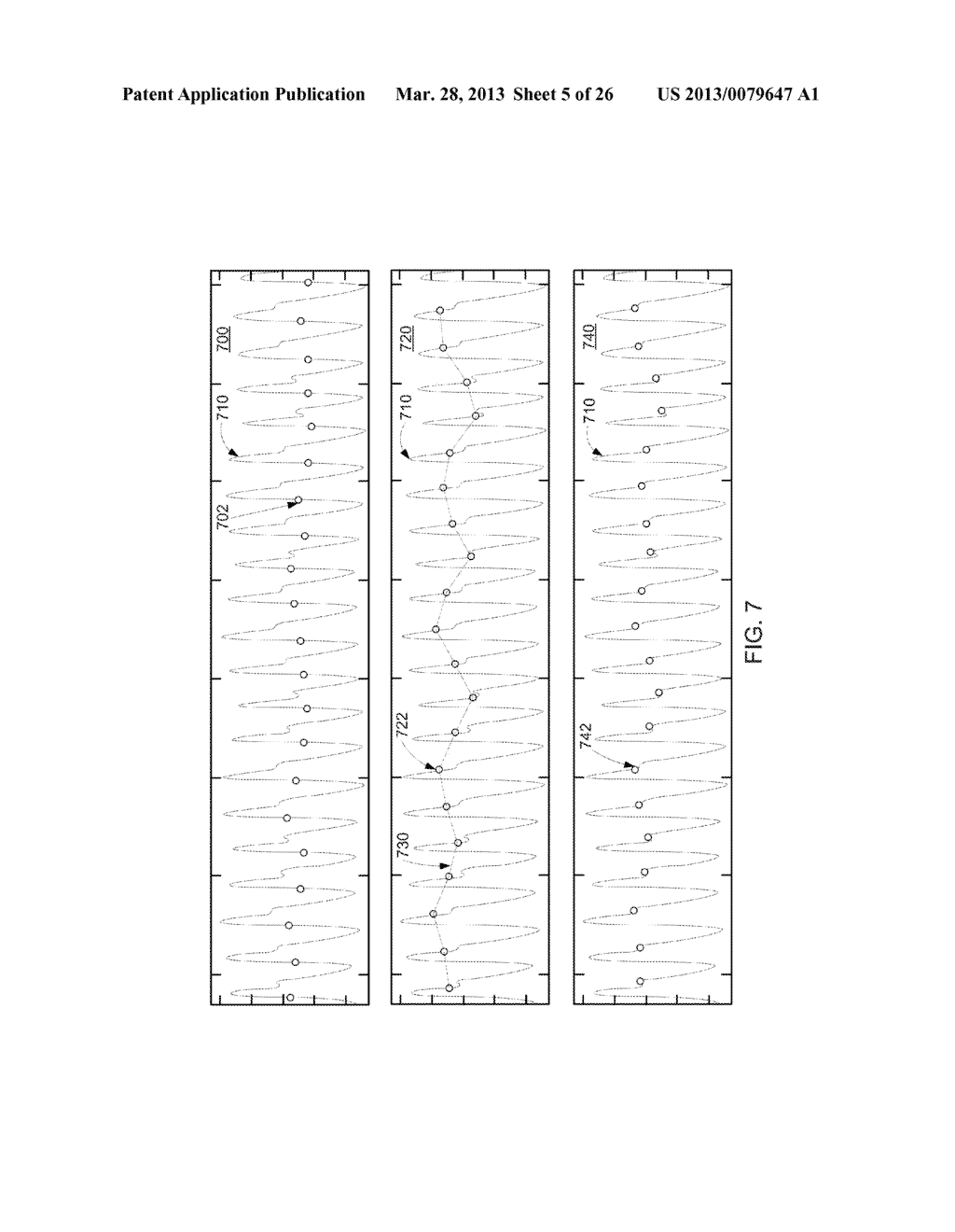 SYSTEMS AND METHODS FOR DETERMINING RESPIRATION INFORMATION FROM A     PHOTOPLETHYSMOGRAPH - diagram, schematic, and image 06