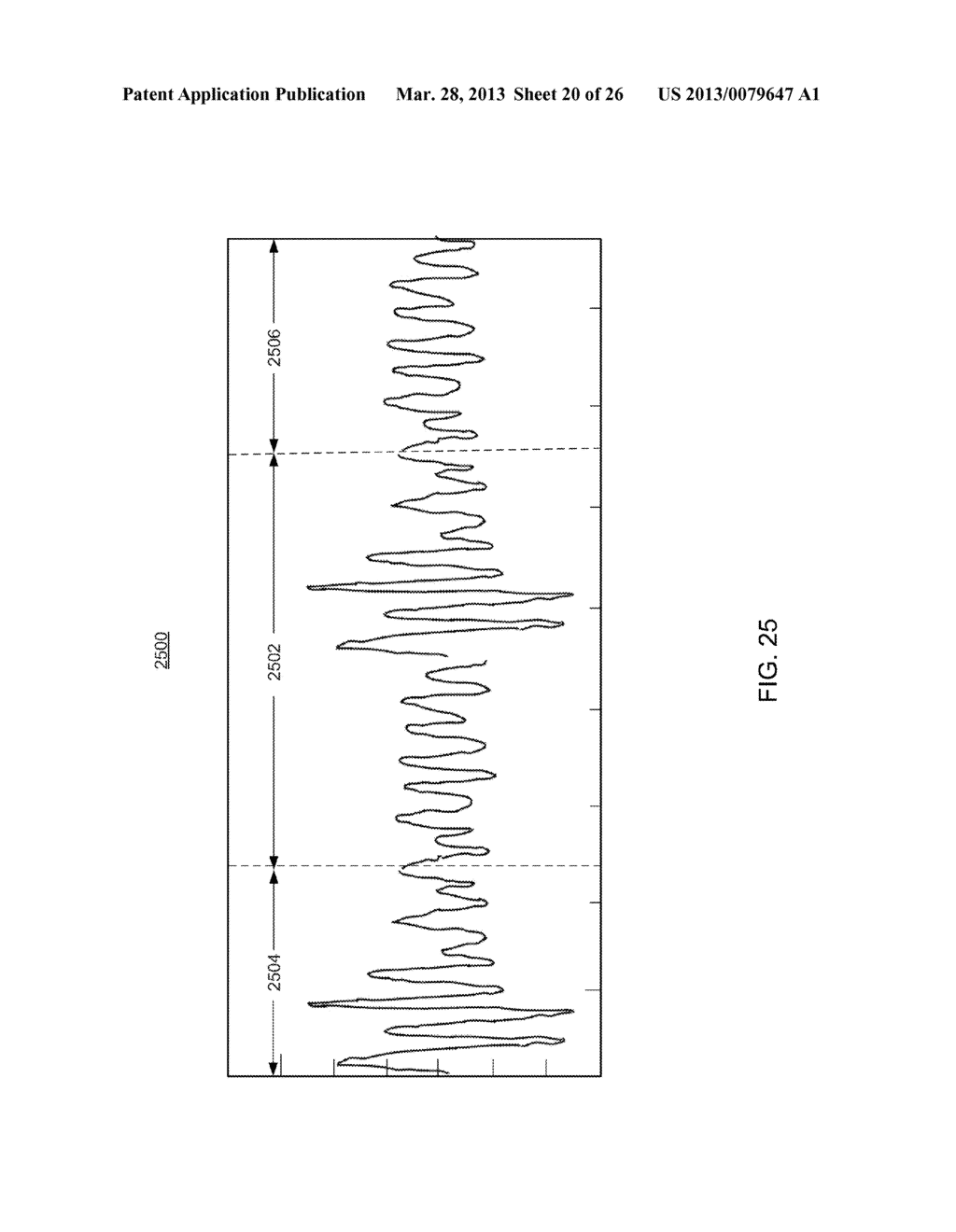SYSTEMS AND METHODS FOR DETERMINING RESPIRATION INFORMATION FROM A     PHOTOPLETHYSMOGRAPH - diagram, schematic, and image 21