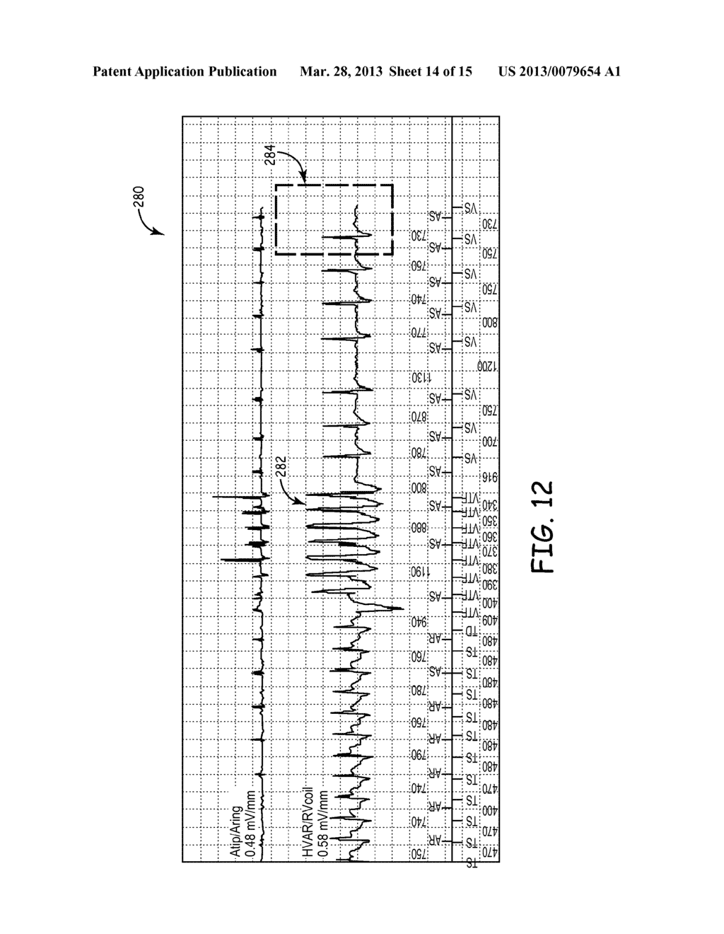 EPISODE CLASSIFIER ALGORITHM - diagram, schematic, and image 15