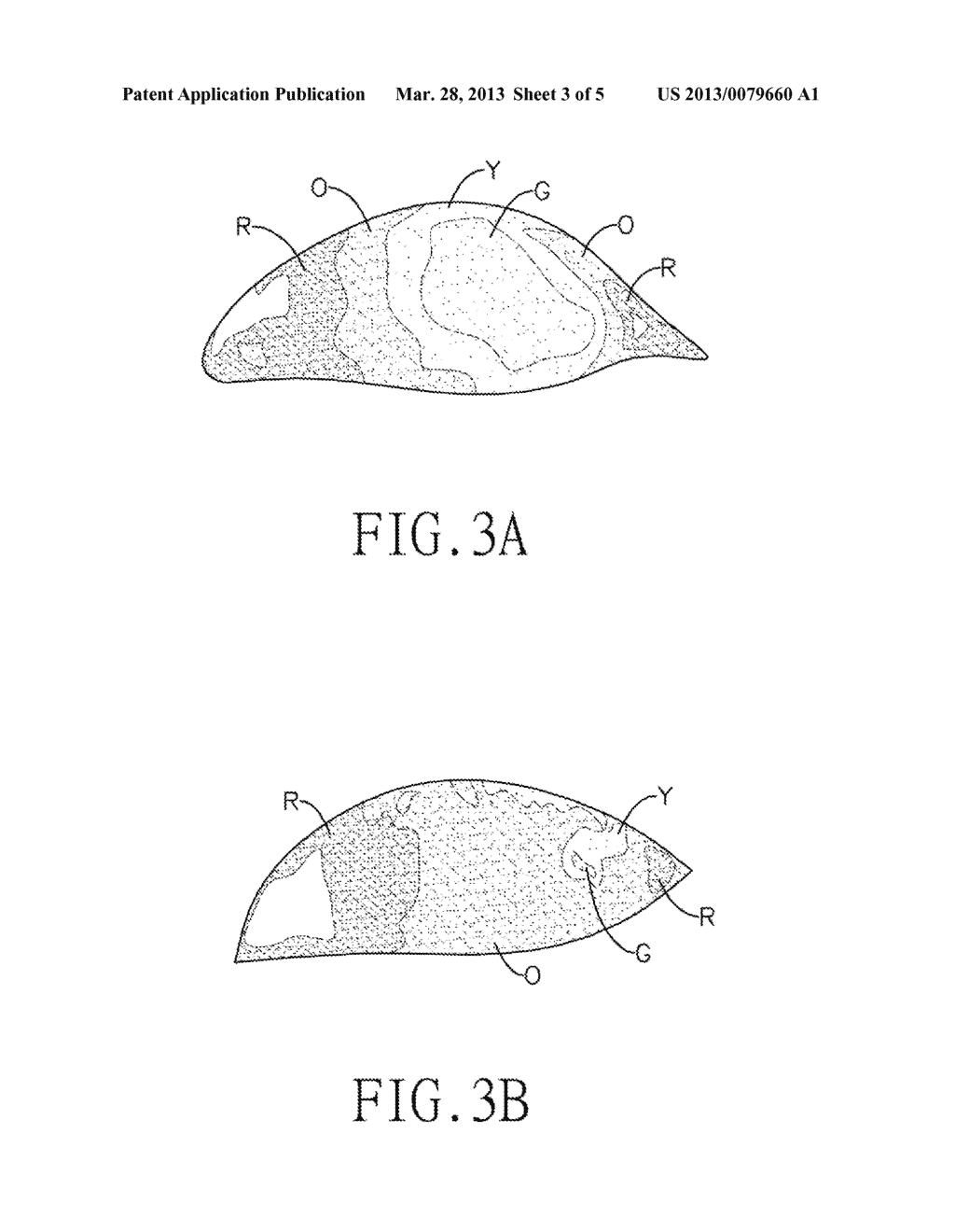 METHOD UTILIZING THERMOGRAPH OF A TEAR FILM FOR GENERATING A QUANTIFIED     INDEX - diagram, schematic, and image 04