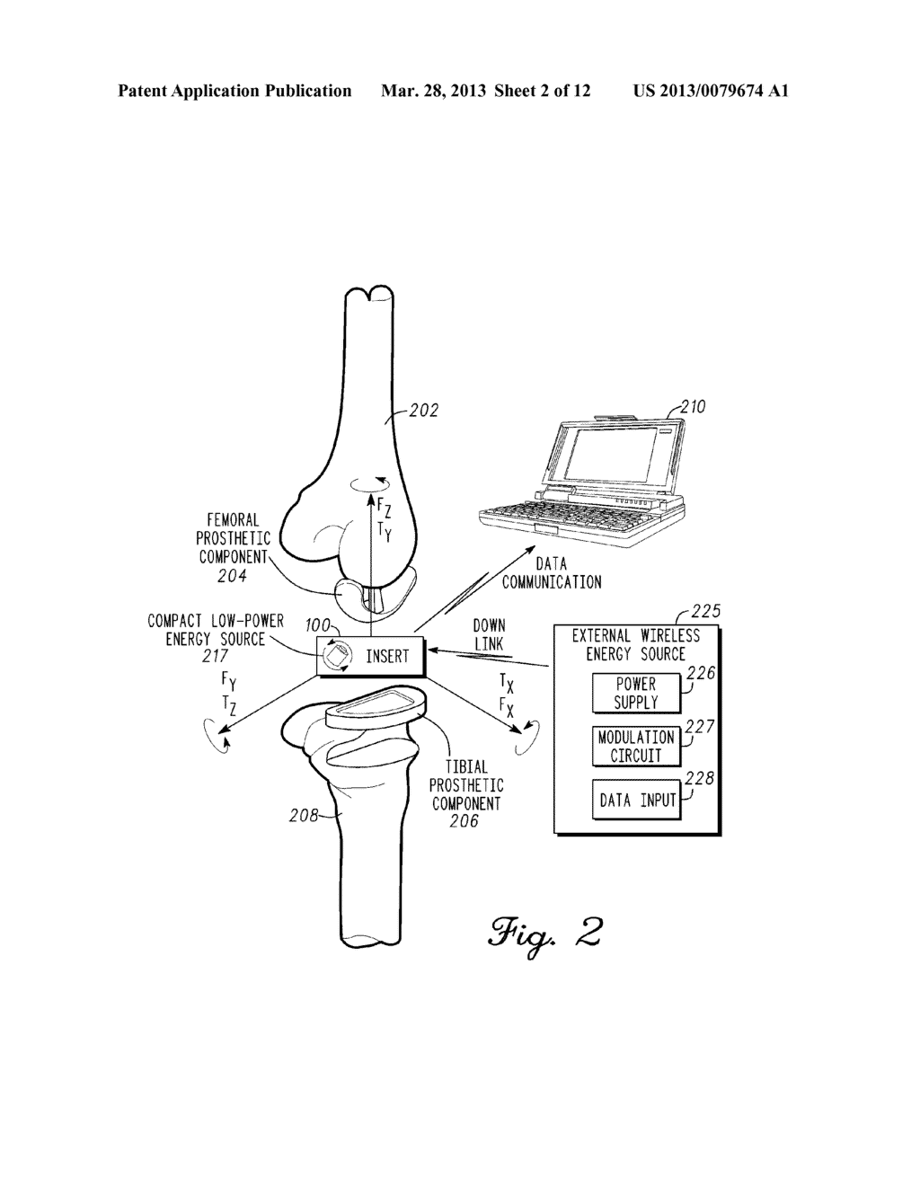 ORTHOPEDIC INSERT MEASURING SYSTEM HAVING A SEALED CAVITY - diagram, schematic, and image 03