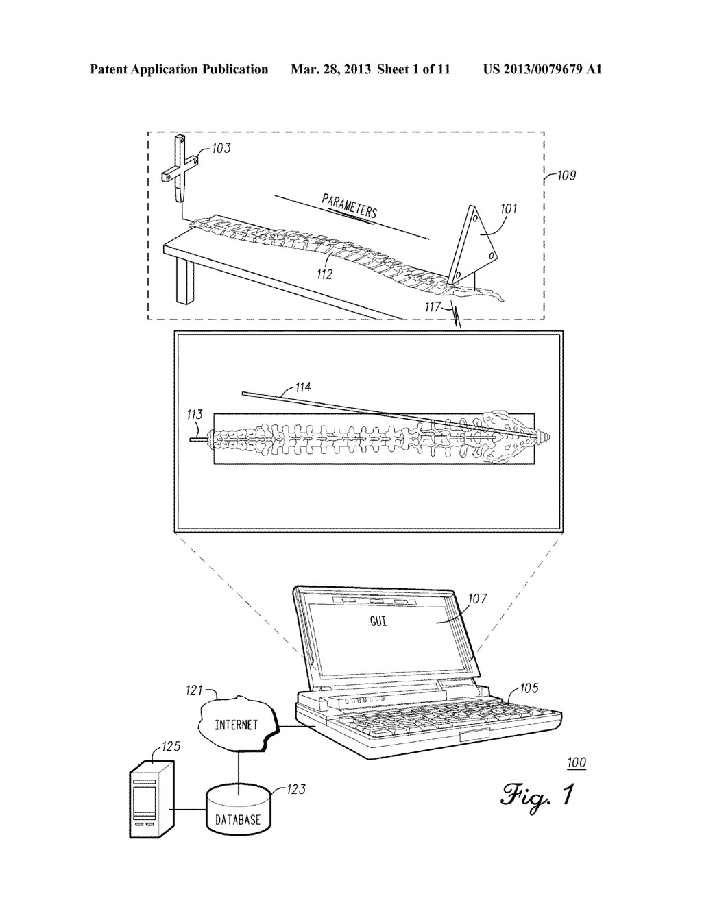 System And Method For Vertebral Load And Location Sensing - diagram, schematic, and image 02