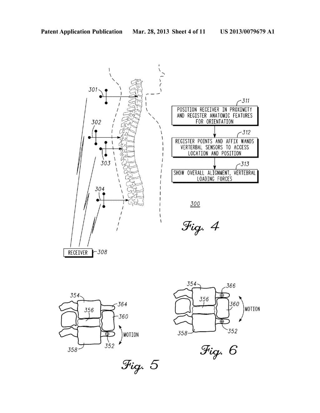 System And Method For Vertebral Load And Location Sensing - diagram, schematic, and image 05