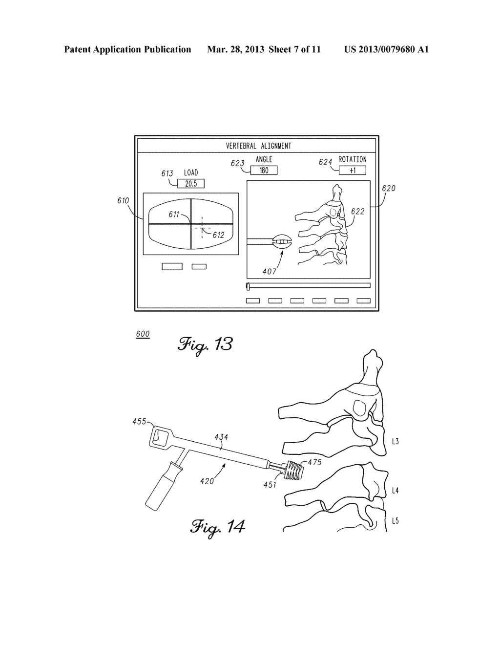 Spinal Distraction Tool For Load And Position Measurement - diagram, schematic, and image 08