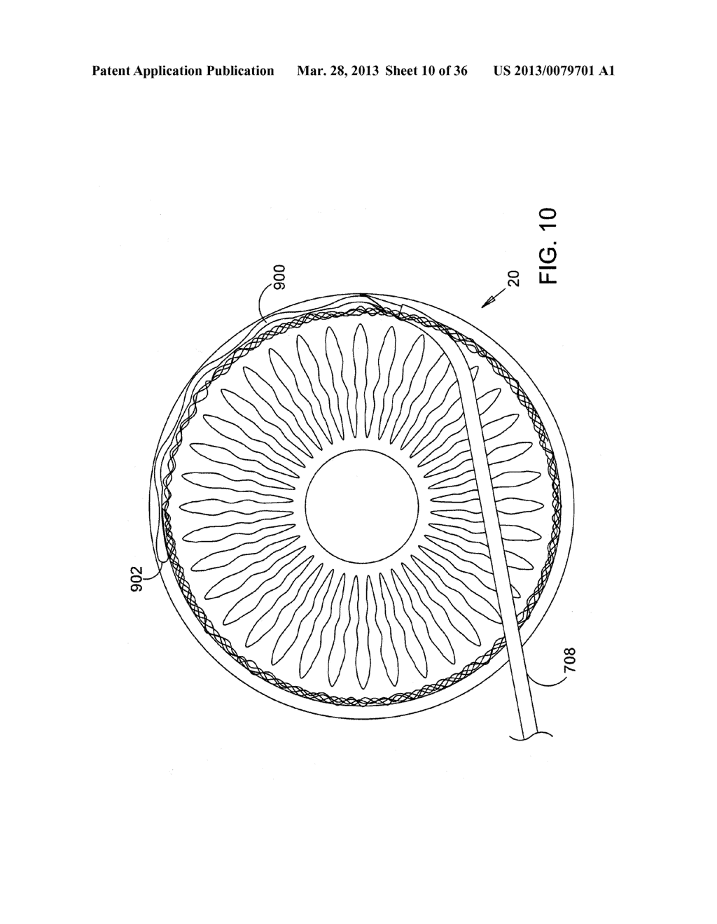 Methods and Apparatus for Delivering Ocular Implants Into the Eye - diagram, schematic, and image 11