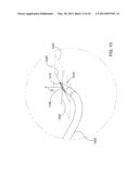 Methods and Apparatus for Delivering Ocular Implants Into the Eye diagram and image