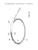 Methods and Apparatus for Delivering Ocular Implants Into the Eye diagram and image