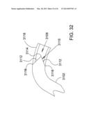 Methods and Apparatus for Delivering Ocular Implants Into the Eye diagram and image