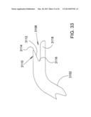 Methods and Apparatus for Delivering Ocular Implants Into the Eye diagram and image