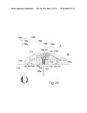 Medical Device diagram and image