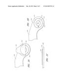 MEDICAL SECUREMENT DEVICE WITH TIMER diagram and image