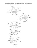 Ultrasonic Surface Treatment Device and Method diagram and image