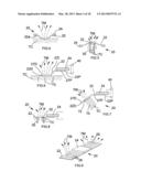 Ultrasonic Surface Treatment Device and Method diagram and image