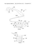 Ultrasonic Surface Treatment Device and Method diagram and image