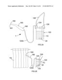 Ultrasonic Surface Treatment Device and Method diagram and image