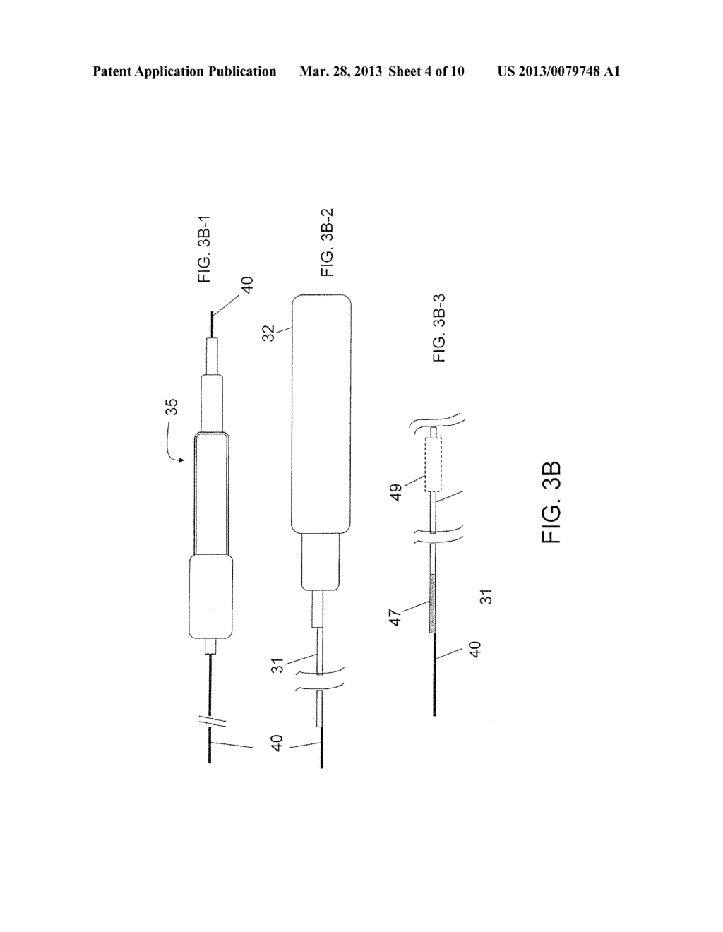 STEPPED CANNULA - diagram, schematic, and image 05