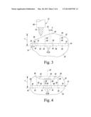 ROTATABLE PATELLA DRILL GUIDE diagram and image