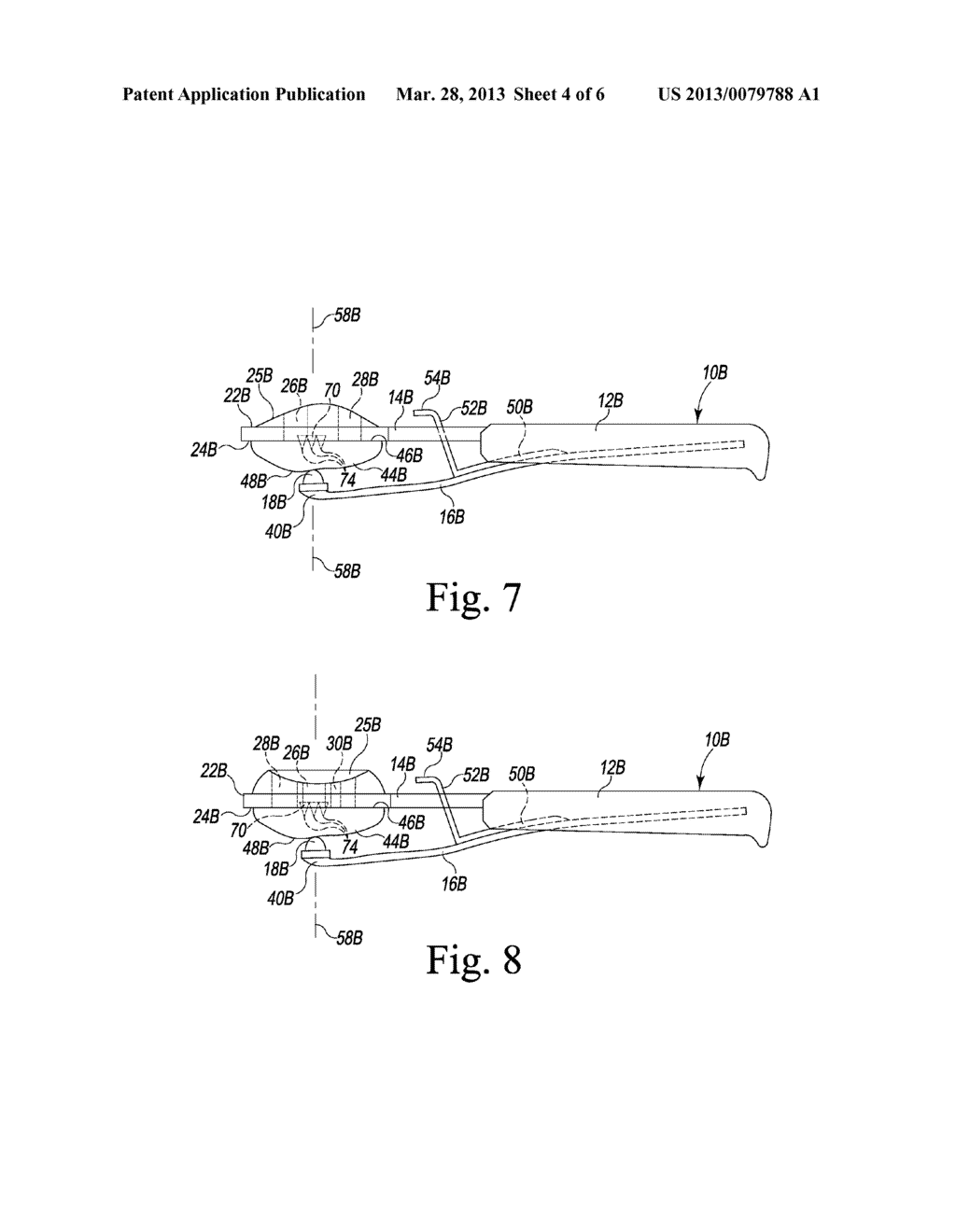 CLAMPING PATELLA DRILL GUIDE - diagram, schematic, and image 05