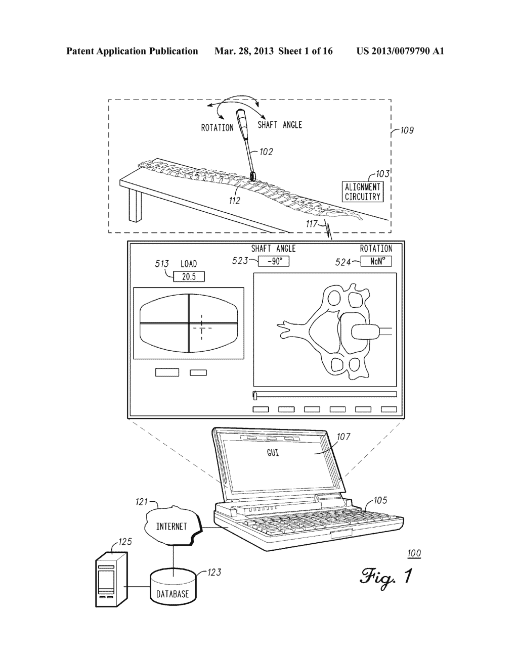 Spine Tool For Measuring Vertebral Load and Position of Load - diagram, schematic, and image 02