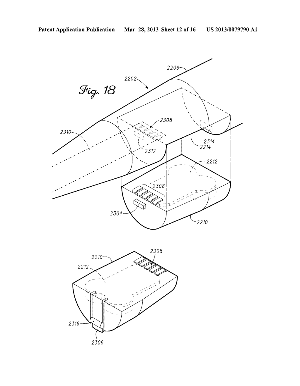 Spine Tool For Measuring Vertebral Load and Position of Load - diagram, schematic, and image 13