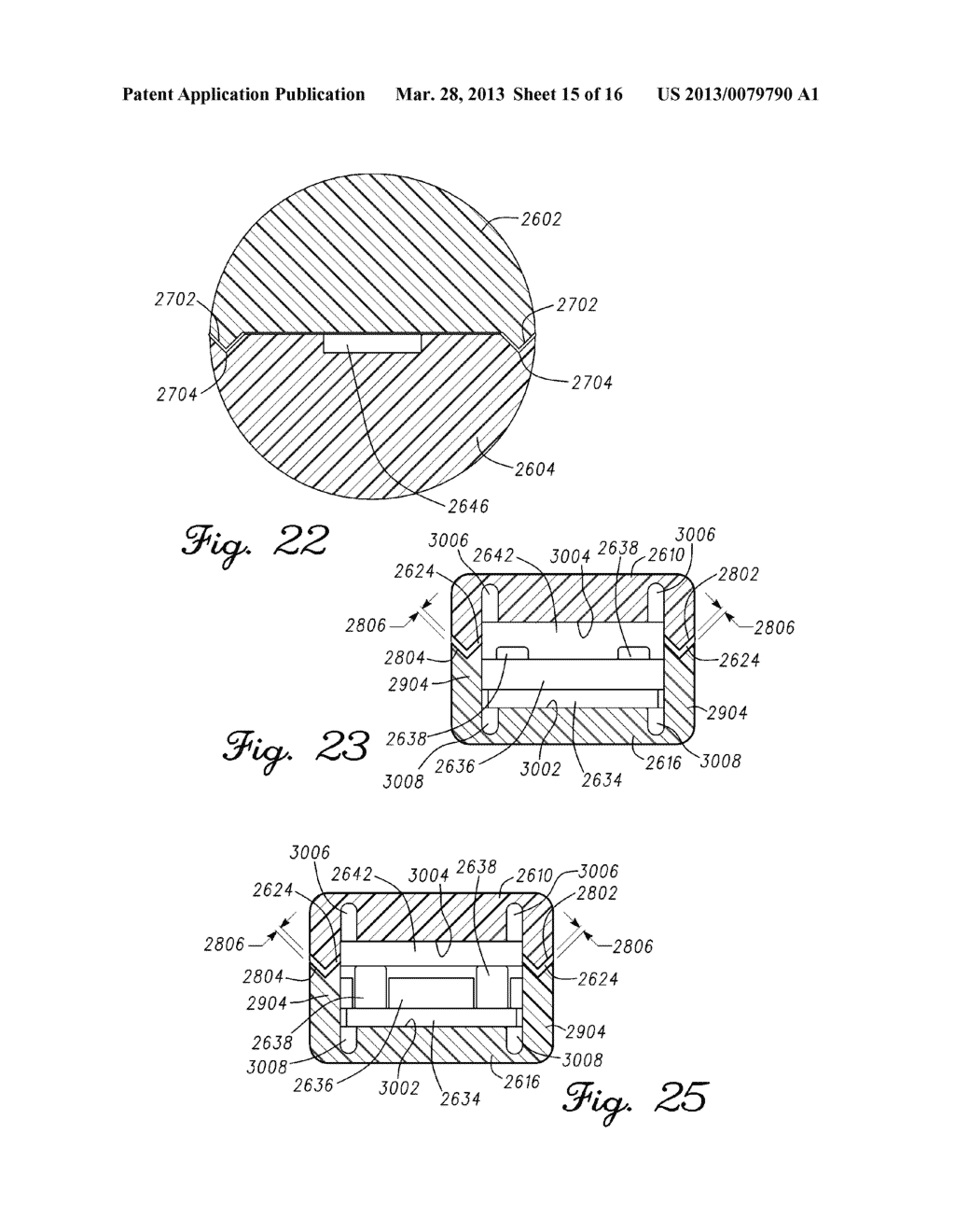 Spine Tool For Measuring Vertebral Load and Position of Load - diagram, schematic, and image 16