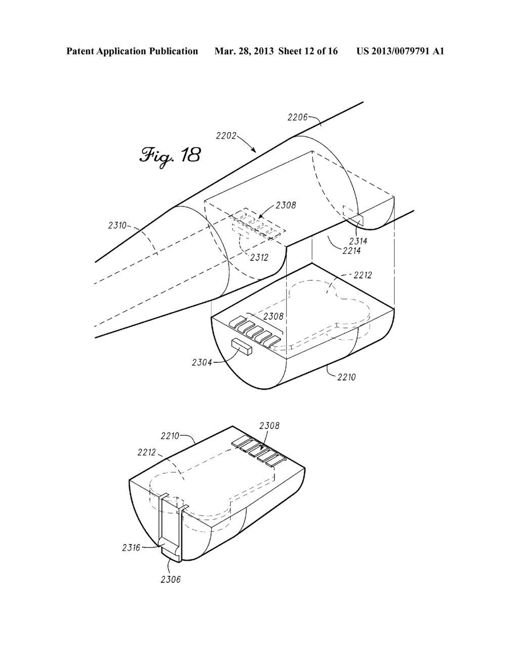 Modular Active Spine Tool For Measuring Vertebral Load and Position of     Load - diagram, schematic, and image 13