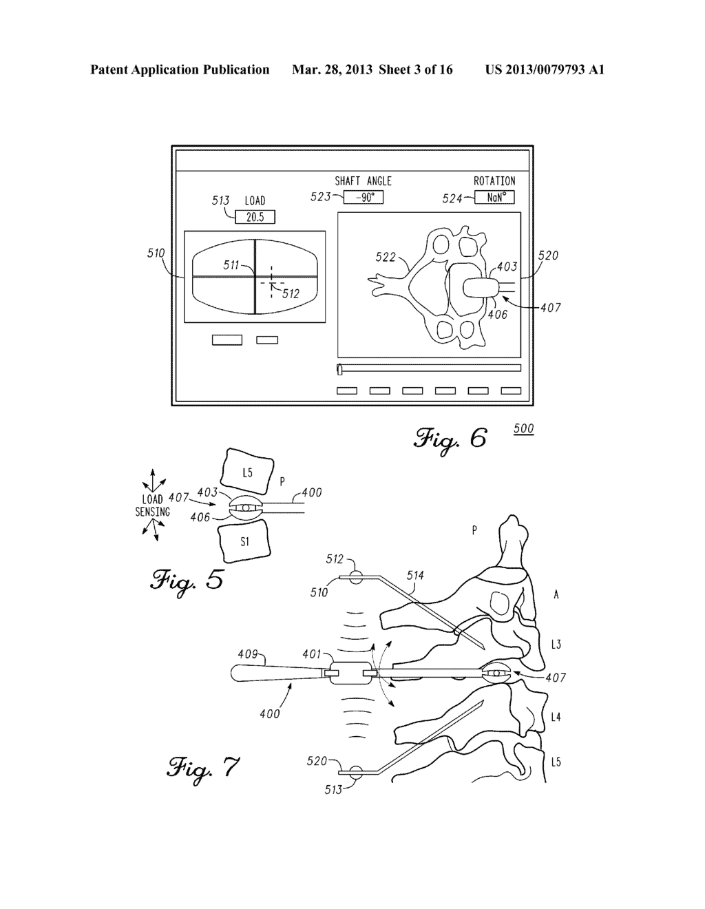 SENSORED HEAD FOR A MEASUREMENT TOOL FOR THE MUSCULAR-SKELETAL SYSTEM - diagram, schematic, and image 04