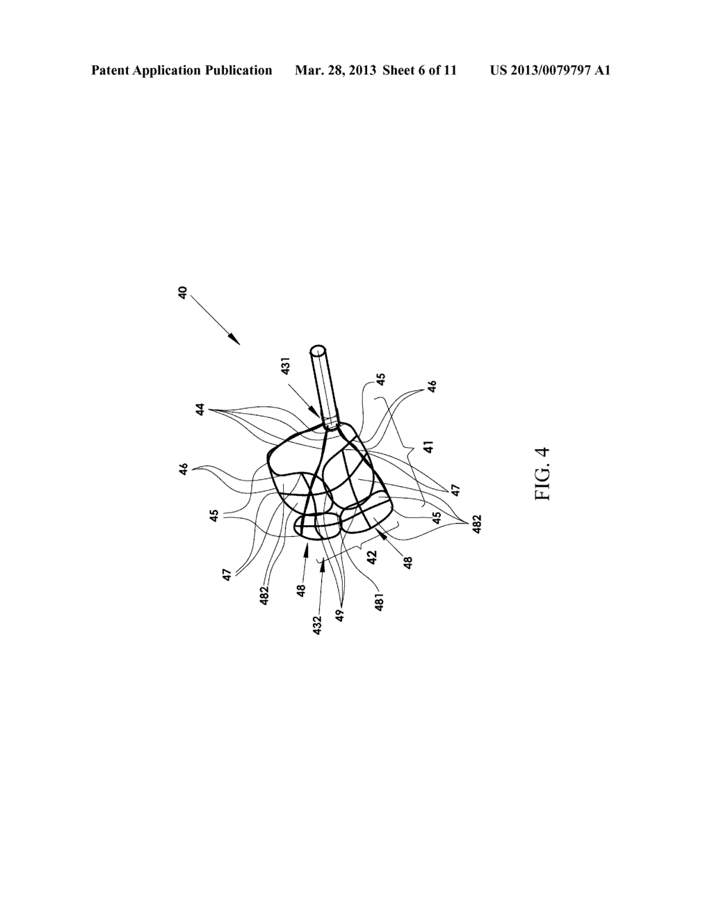 DEVICE AND METHOD FOR FRAGMENTING AND REMVOING CONCRETIONS FROM BODY DUCTS     AND CAVITIES - diagram, schematic, and image 07