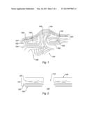 PROTHESIS COMPRISING A REINFORCED MESH diagram and image