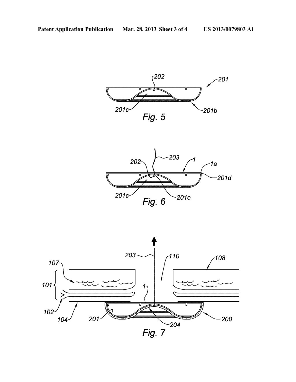 PROTHESIS COMPRISING A REINFORCED MESH - diagram, schematic, and image 04