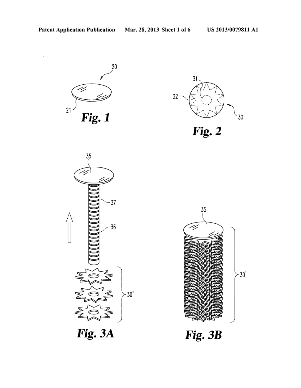 DEVICES AND METHODS FOR TREATING FISTULAE AND OTHER BODILY OPENINGS AND     PASSAGEWAYS - diagram, schematic, and image 02