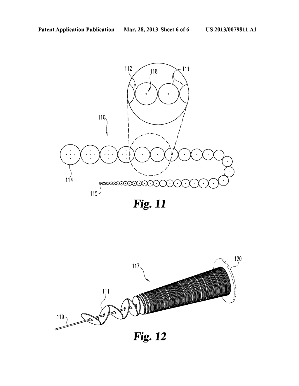 DEVICES AND METHODS FOR TREATING FISTULAE AND OTHER BODILY OPENINGS AND     PASSAGEWAYS - diagram, schematic, and image 07