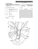 KNOTLESS SUTURE ANCHOR diagram and image