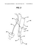 KNOTLESS SUTURE ANCHOR diagram and image