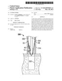 SUTURE ANCHOR diagram and image