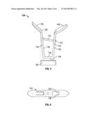 SUTURE ANCHOR diagram and image