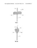 Knotted Suture End Effector diagram and image