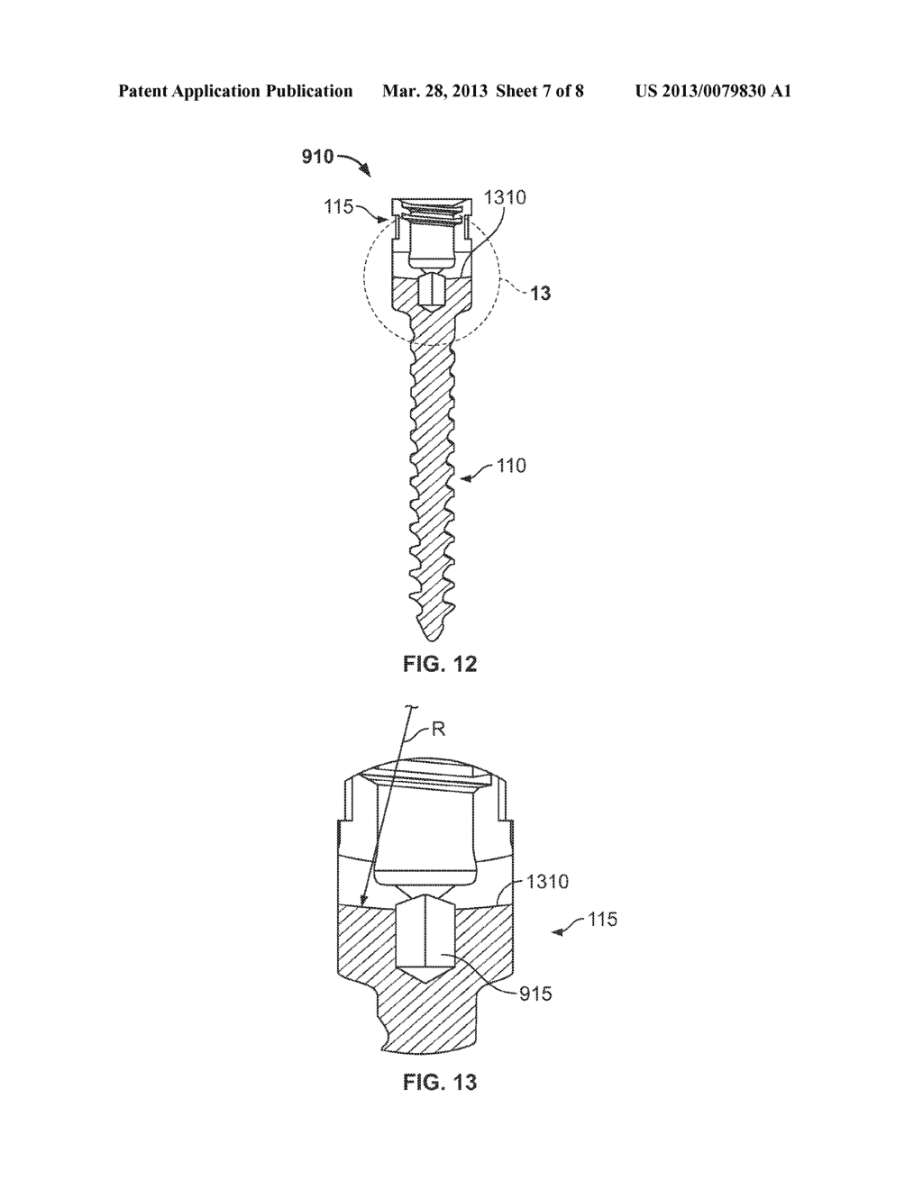 PEDICLE SCREW ASSEMBLY - diagram, schematic, and image 08