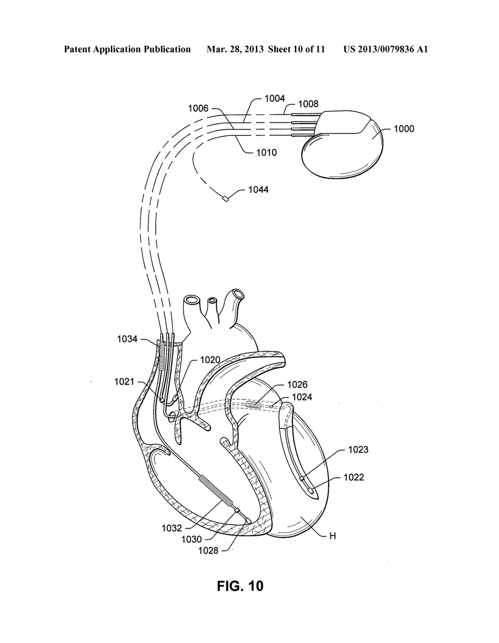 RF TRANSCEIVER HOPPING FOR COMMUNICATION WITH IMPLANTABLE MEDICAL DEVICE - diagram, schematic, and image 11