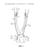 NEURAL CONTROL OF CENTRAL SLEEP APNEA diagram and image